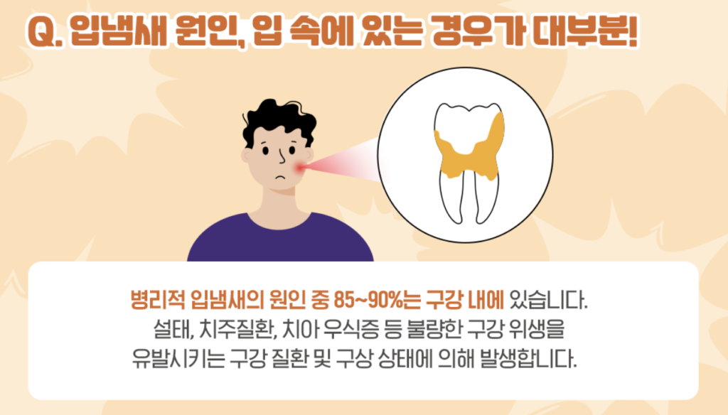 입냄새의 원인