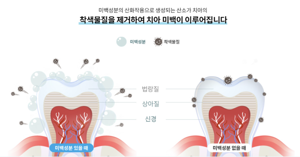 치아미백의 원리