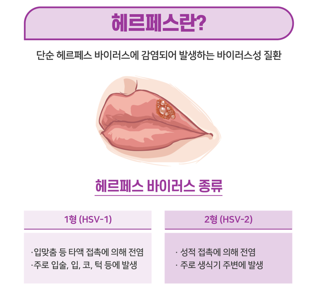 헤르페스 바이러스