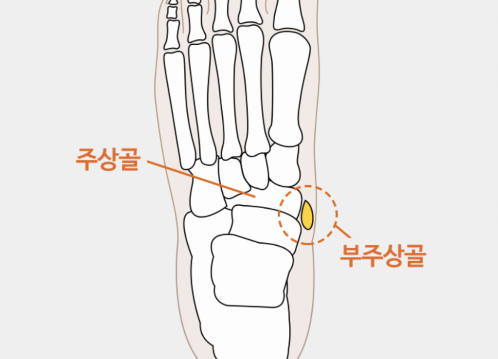 부주상골